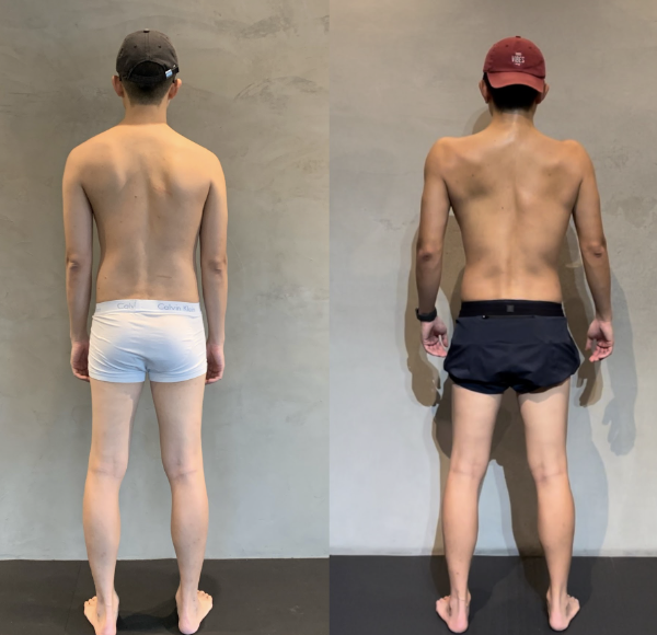 站姿與步態進步