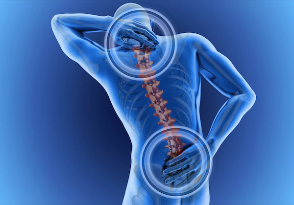 平坦脊柱引起的背痛 